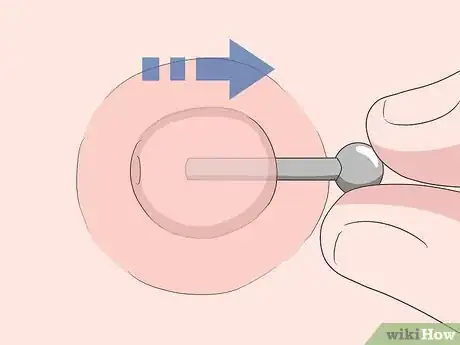 Image titled Remove a Nipple Piercing Step 8