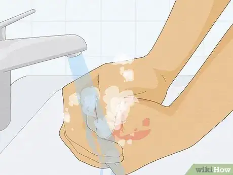 Image titled Remove Kool Aid from Skin Step 5