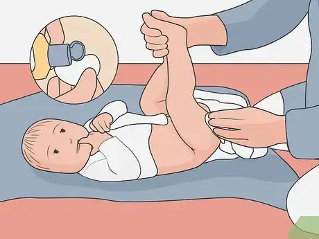 Image titled Care for a Circumcized Baby Step 2