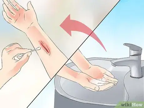 Image titled Practice Good Hand Hygiene Step 30