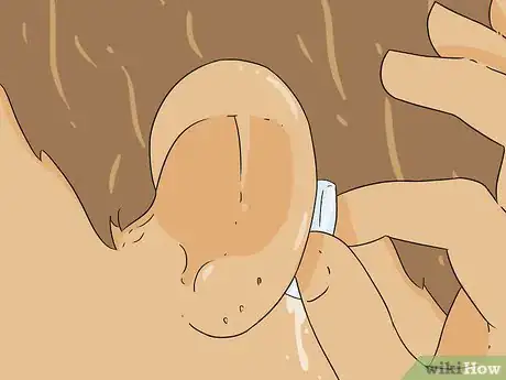 Image titled Re‐Pierce Ears Step 13