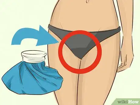 Image titled Soothe a Sore Vagina Step 1