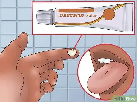 Image titled Treat Oral Thrush Step 12