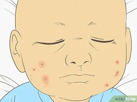 Image titled Know What to Expect on a Newborn's Skin Step 7