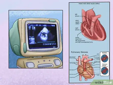 Image titled Diagnose Heart Conditions in Doberman Pinschers Step 10