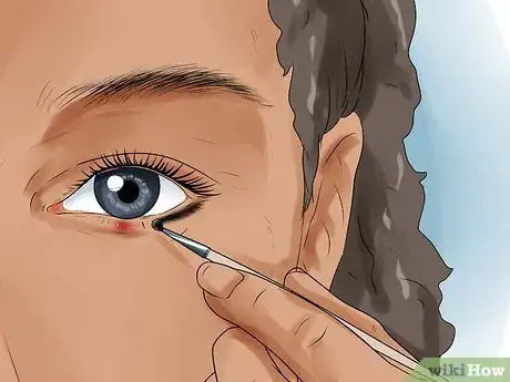 Image titled Get Rid of a Stye Step 11