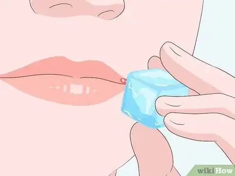 Image titled Get Rid of a Cold Sore Step 12