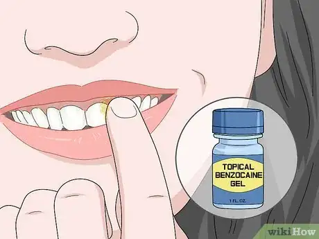 Image titled Relieve Sinus Tooth Pain Step 2