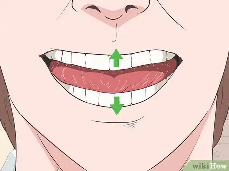 Image titled Alleviate Temporomandibular Joint Disorder (TMD) Step 3