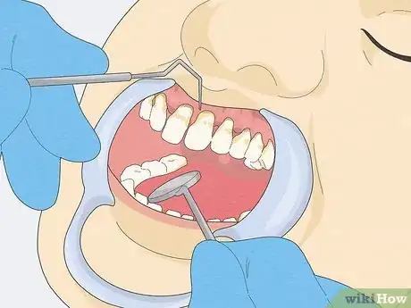 Image titled Fix Rotting Teeth Step 5