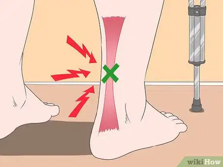 Image titled Wrap an Achilles Tendon Step 13