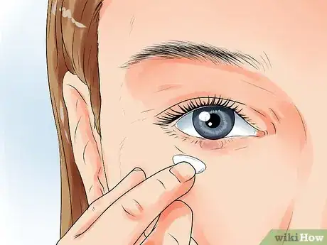 Image titled Get Rid of a Stye Step 10