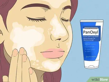 Image titled Clear Bad Skin Step 10