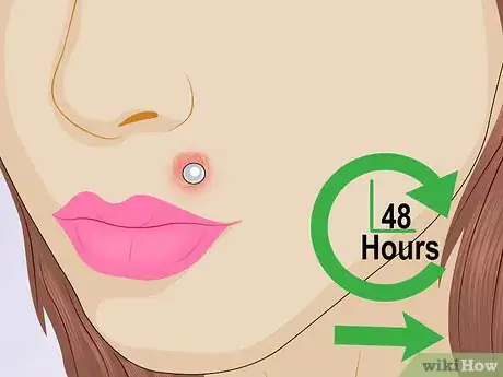 Image titled Tell if a Piercing Is Infected Step 2