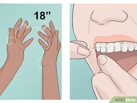 Image titled Stimulate Gum Growth Step 12