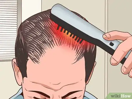 Image titled Regrow Hair Step 5