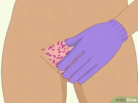 Image titled Shave Your Vagina for Sex Step 4