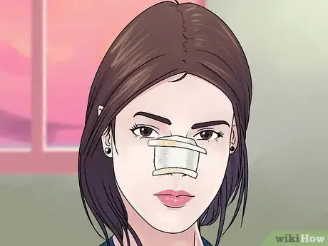 Image titled Reduce Swelling After Rhinoplasty Step 11