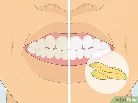 Image titled Whiten Your Teeth with Banana Peel Step 1