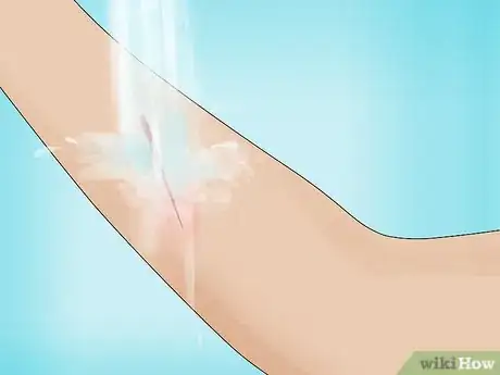 Image titled Make a Quick Disinfectant for Minor Cuts and Abrasions Step 2