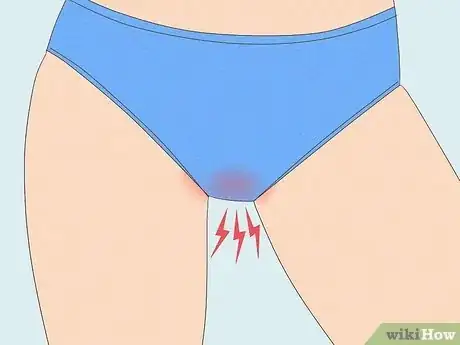 Image titled Recognize Vulva Cancer Symptoms Step 3