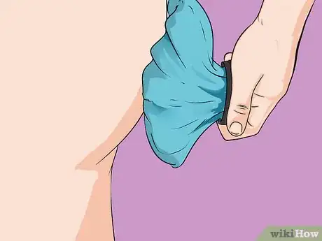 Image titled Treat Hemorrhoids After Pregnancy Step 2