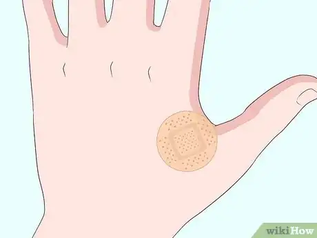 Image titled Stop Warts from Bleeding Step 4