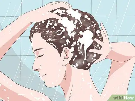 Image titled Heal Scalp Eczema Step 9