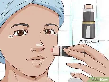 Image titled Painlessly Pop a Pimple Step 11