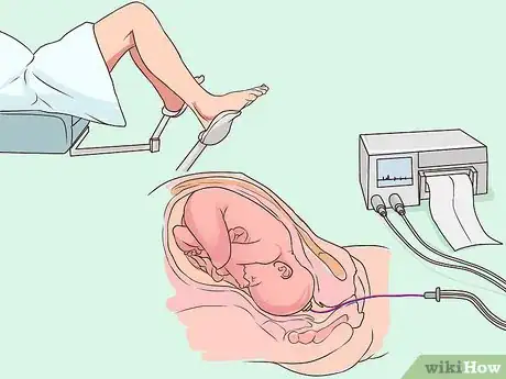 Image titled Monitor Fetal Heart Rate Step 7