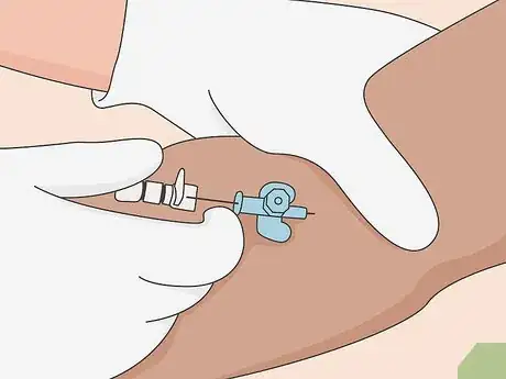 Image titled Administer General Anesthesia Step 5