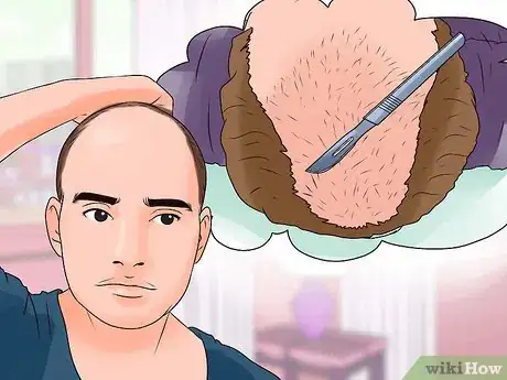 Image titled Stop Rapid Hair Loss Step 18