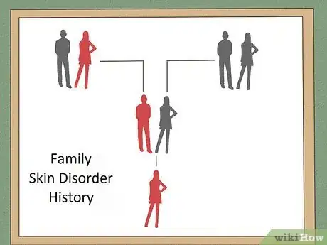 Image titled Diagnose Vitiligo Step 3