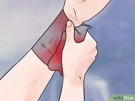 Image titled Decide to Use a Tourniquet (Home Remedy) Step 5