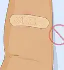 Properly Place a TB Skin Test