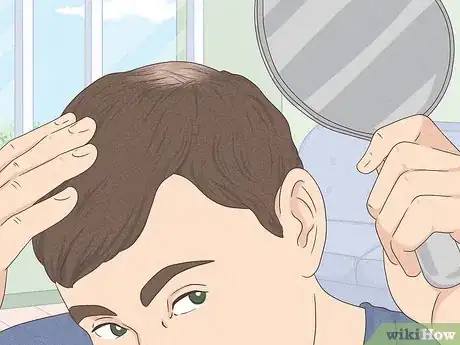 Image titled Know if You Have Male Pattern Baldness Step 1