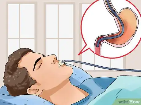 Image titled Diagnose Pancreatic Cancer Step 11