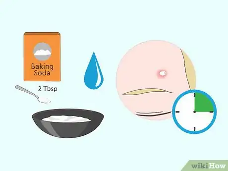 Image titled Shrink Pimples Step 5