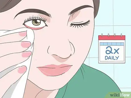 Image titled Treat Blepharitis Step 11