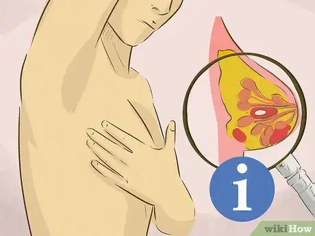 Image titled Treat Breast Cysts Step 1