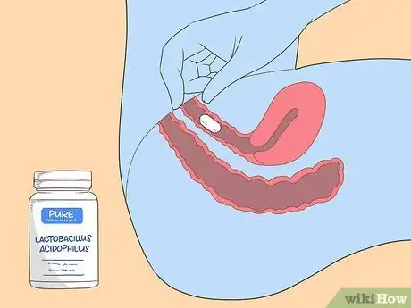 Image titled Increase Lactobacilli Step 9