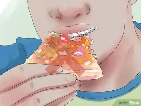 Image titled Eat With Braces Step 6