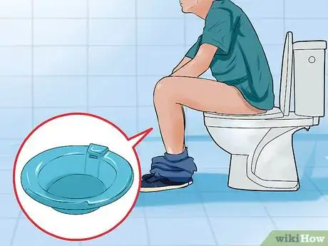 Image titled Stop Hemorrhoids from Itching Step 1