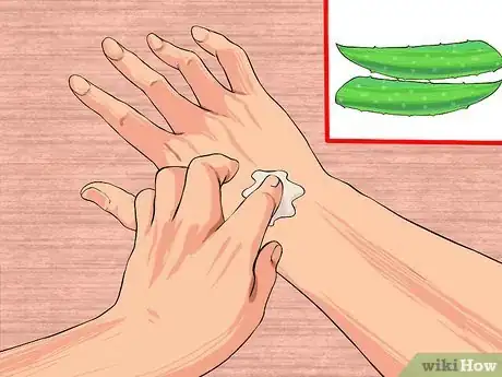 Image titled Grow and Use Aloe Vera for Medicinal Purposes Step 8