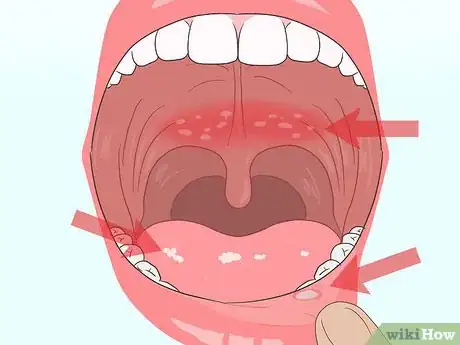 Image titled Prevent Dry Mouth While Sleeping Step 9