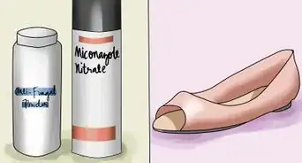 Get Rid of Toe Fungus