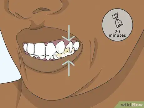 Image titled Use Clove Oil for Tooth Pain Step 9