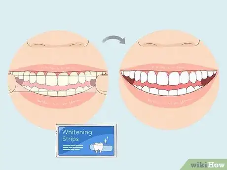 Image titled Have the Perfect Smile Step 12