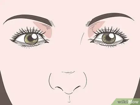 Image titled Treat Blepharitis Step 12