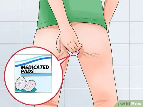 Image titled Stop Hemorrhoids from Itching Step 3